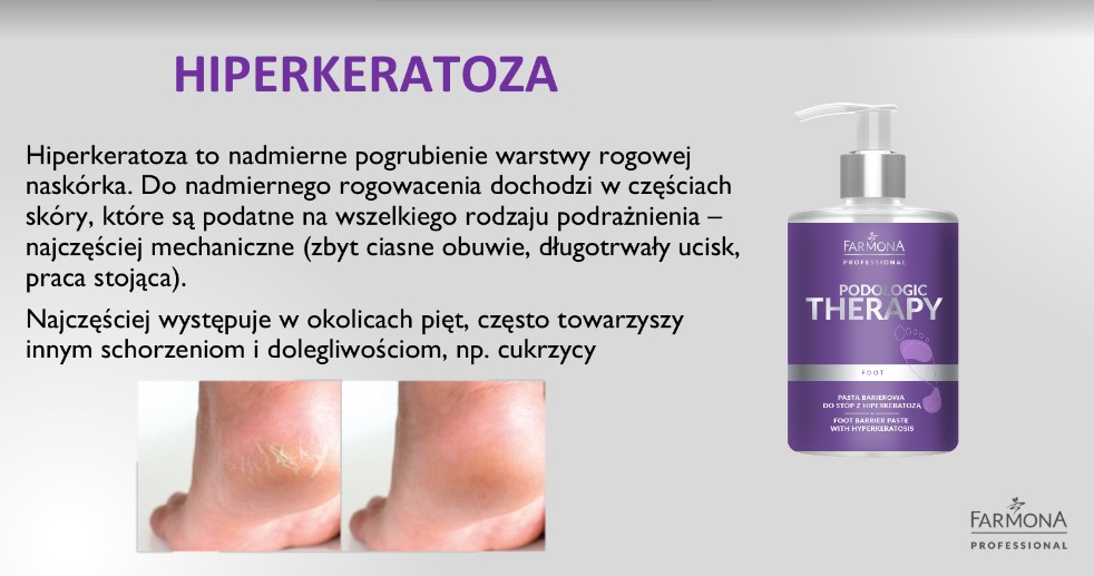 PODOLOGIC THERAPY PASTA BARIEROWA DO STÓP Z HIPERKERATOZĄ 300ml - obrazek 5